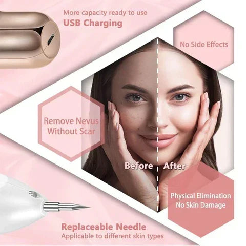 Dispositivo de plasma facial para resultados profesionales. Eliminador de manchas, verrugas y marcas de piel.