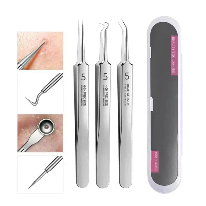 Kit de 3 herramientas de acero inoxidable para eliminación de puntos negros y limpieza facial.