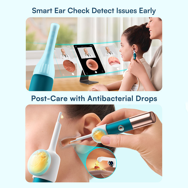 Limpieza de oídos para niños y adultos con cámara HD, promueve la salud familiar y evita infecciones.