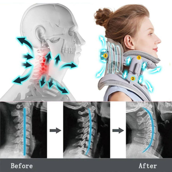 Estirador cervical cómodo para soporte postural y relajación profunda del cuello.