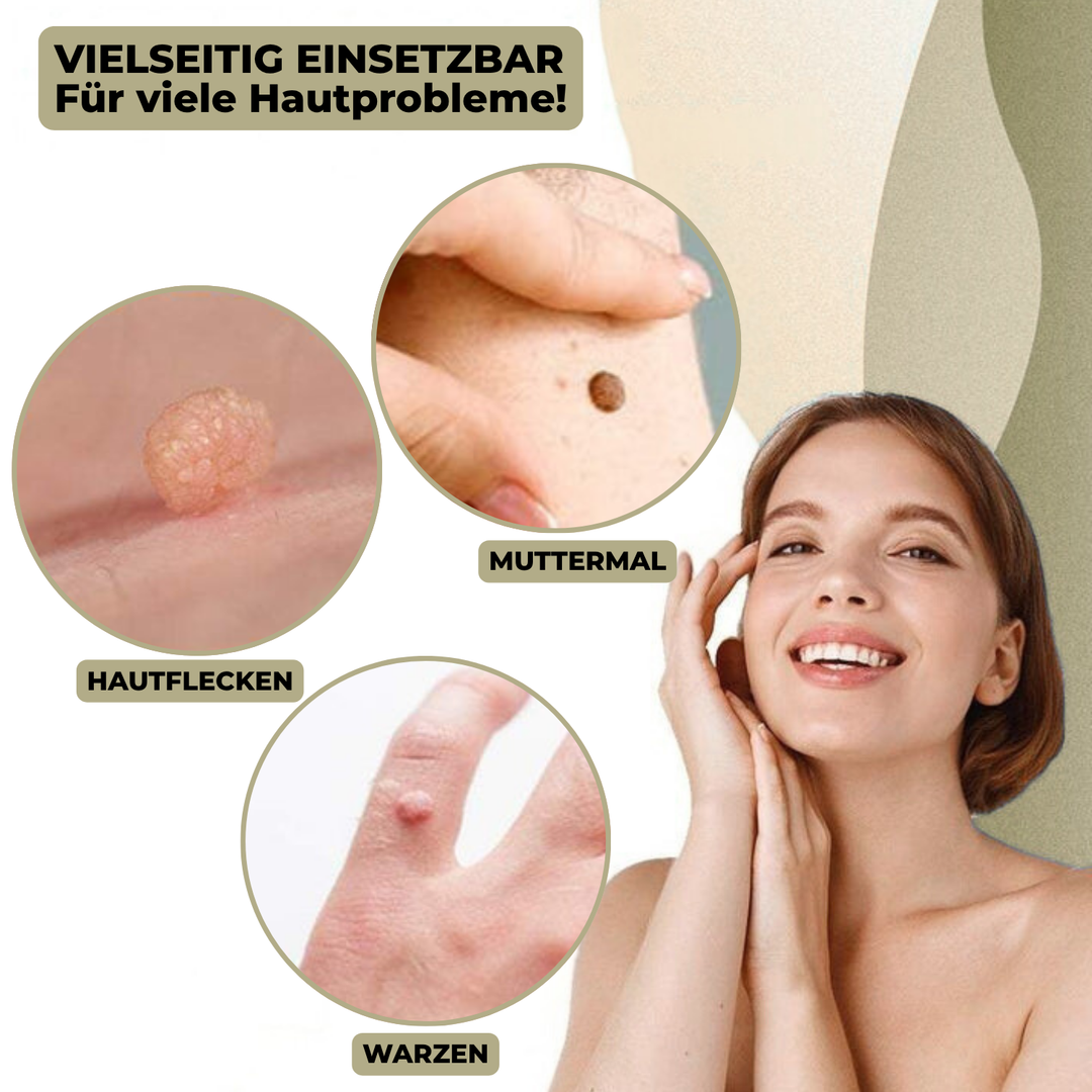 Removedor portátil de verrugas y lunares, fácil de usar en casa. Cuidado de la piel con resultados dermatológicos.