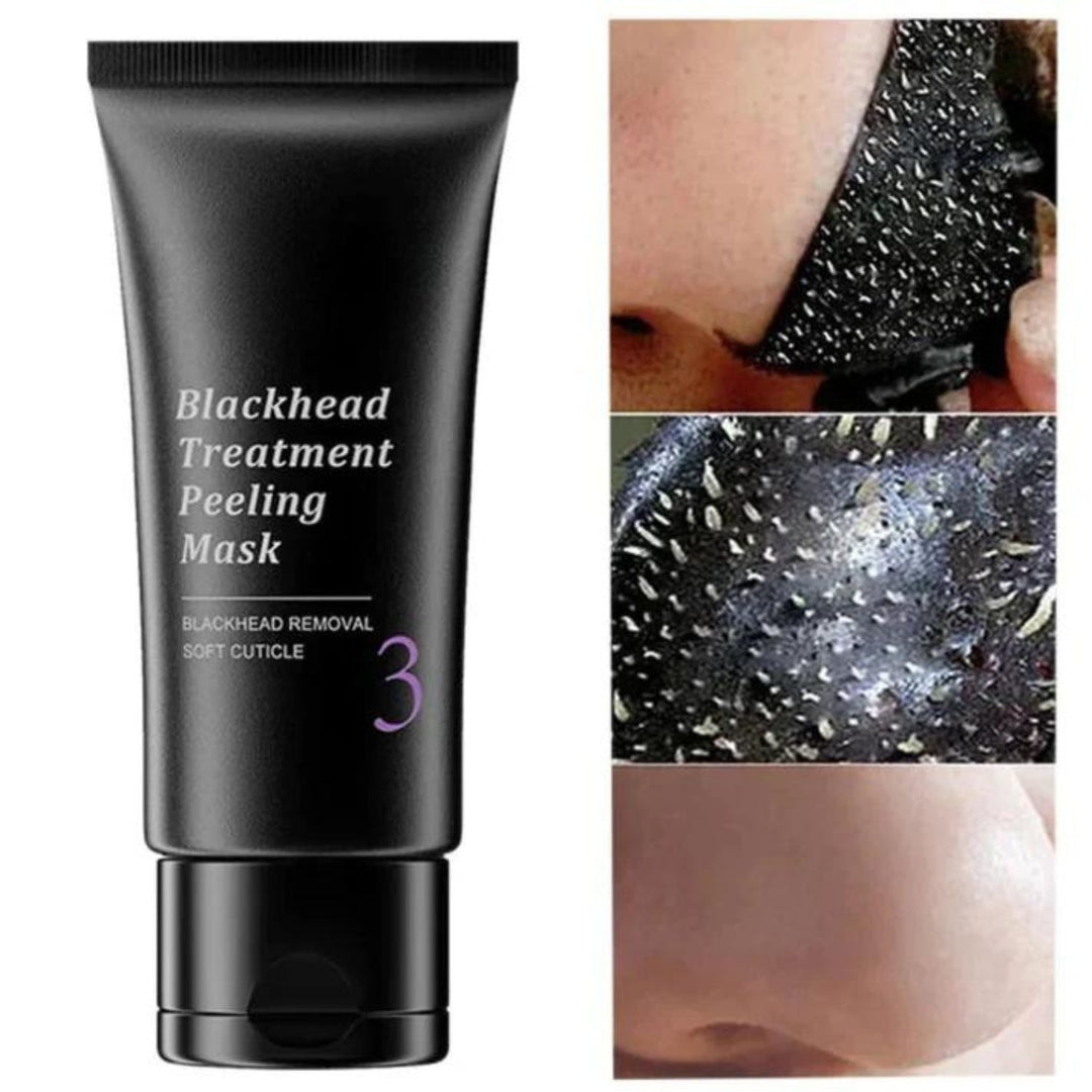 Kit profesional de extracción para puntos negros y poros, herramientas de acero inoxidable para limpieza facial.
