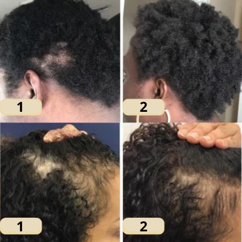 Tratamiento capilar natural y vegano para estimular el crecimiento, dar volumen y prevenir la caída del cabello.