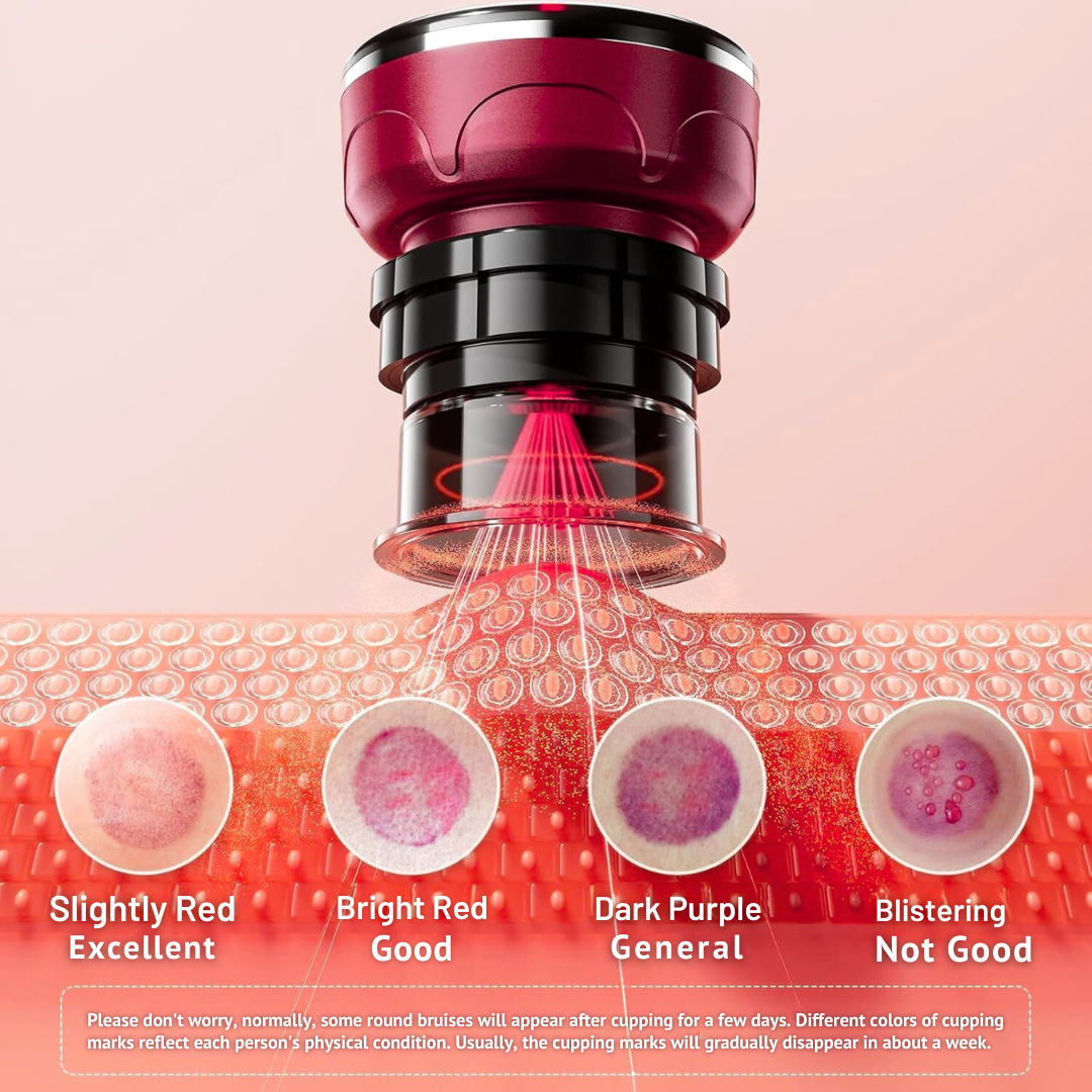 Masajeador inteligente de ventosas y calor con ajustes personalizables para terapia muscular efectiva.