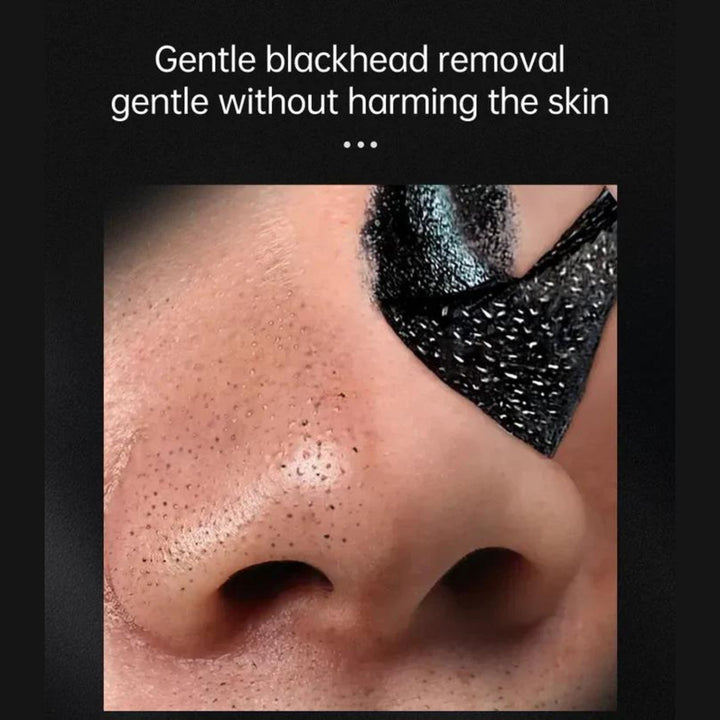 Herramientas de acero inoxidable para eliminar puntos negros, espinillas y comedones, kit de limpieza facial.