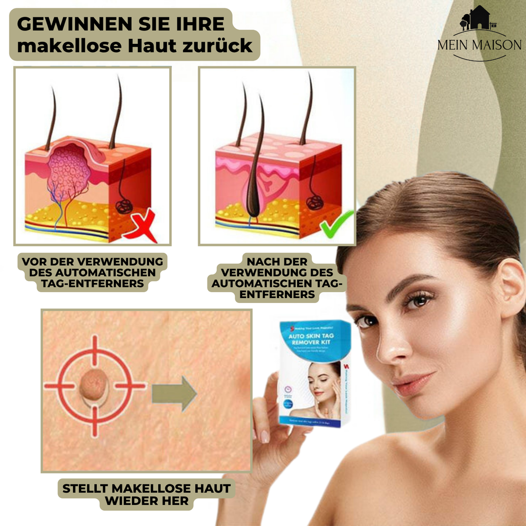 Empaque del removedor de verrugas y lunares sin dolor. Solución de belleza y cuidado de la piel para el hogar.