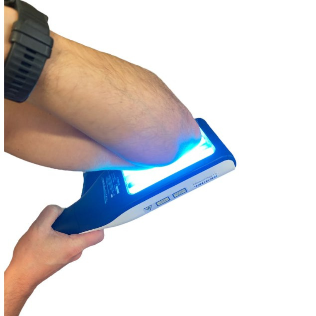 Lámpara de terapia UVB compacta y ligera. Cuidado de la piel, dispositivo médico fácil de usar y guardar.