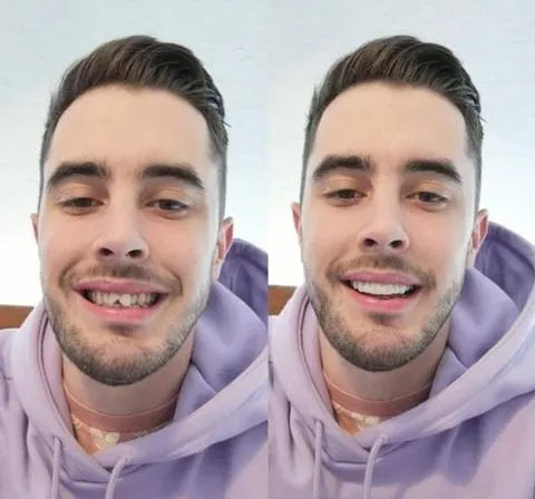 Carillas dentales correctoras estéticas para blanqueamiento y dientes perfectos. Solución temporal unisex para mejorar tu sonrisa.