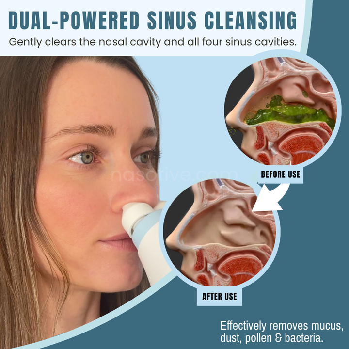 Dispositivo eléctrico para lavado nasal y limpieza profunda. Alivia alergias, congestión y mejora salud respiratoria.