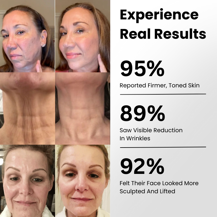 Dispositivo de tratamiento facial con luz LED, microcorriente EMS para firmeza y luminosidad de la piel.
