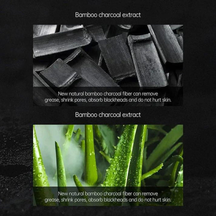 Piel limpia y libre de imperfecciones con este kit extractor de puntos negros y tratamiento de acné.