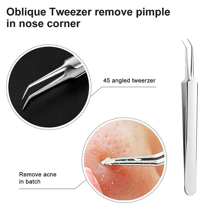 Solución para piel limpia: kit removedor de puntos negros y extractor de espinillas facial.
