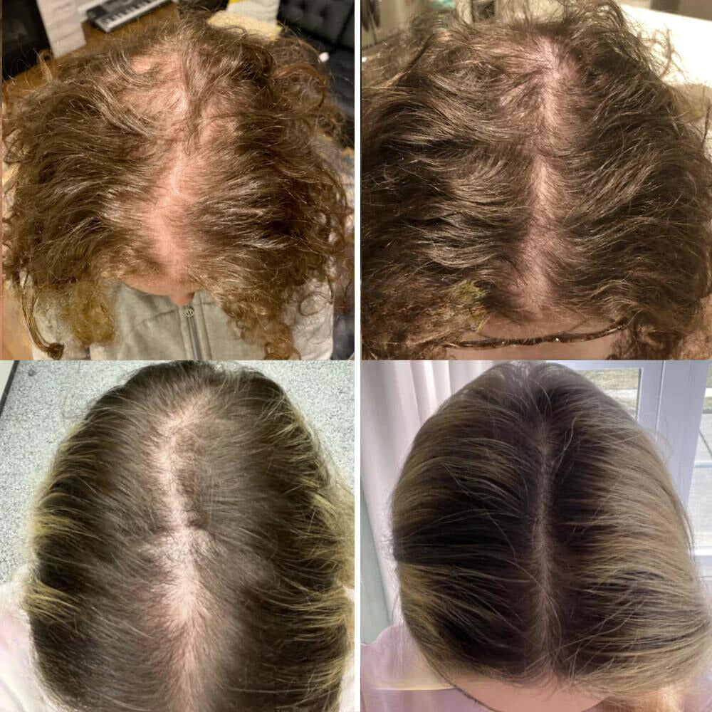 Aceite capilar vegano para el crecimiento y engrosamiento del cabello. Solución natural para cabello fino.