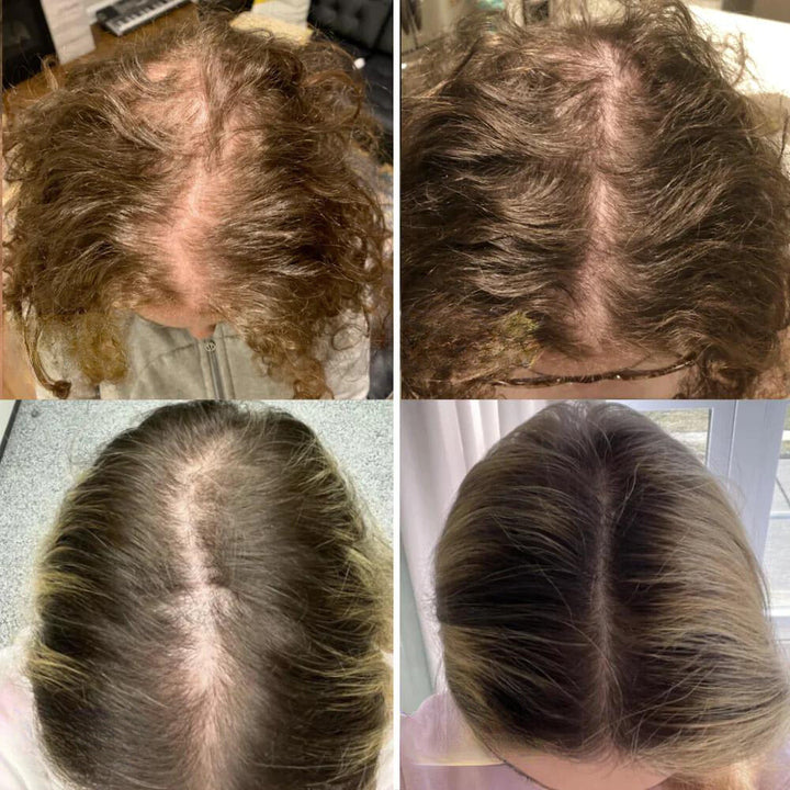 Aceite capilar vegano para el crecimiento y engrosamiento del cabello. Solución natural para cabello fino.