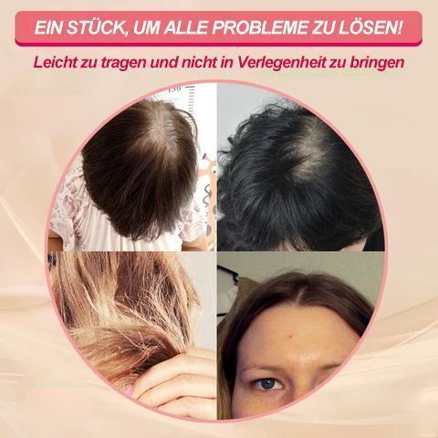 Solución para calvicie femenina: topper de cabello natural. Aporta volumen y densidad al instante.