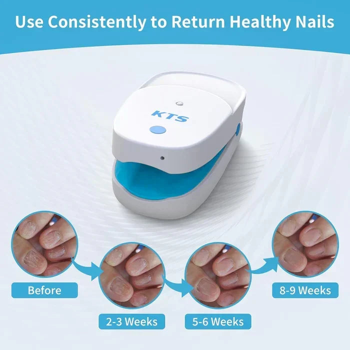 Dispositivo láser para uñas, modelo dual avanzado, portátil y recargable.