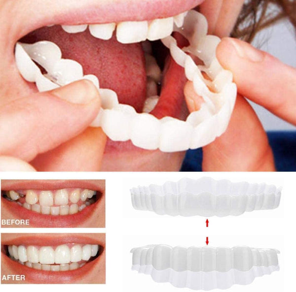 Transforma tu sonrisa con carillas dentales estéticas temporales. Dientes perfectos y blancos al instante para hombre y mujer.