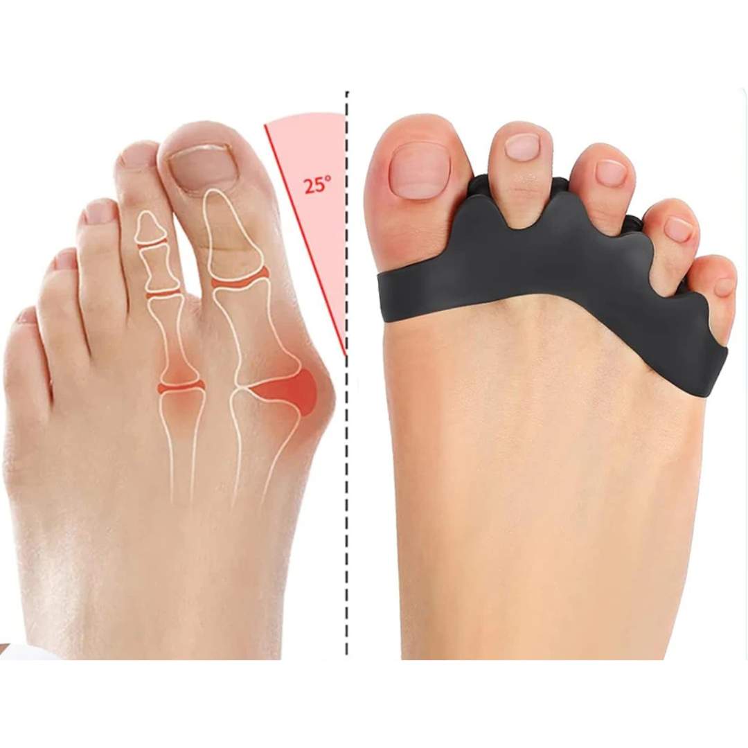 Corrector de dedos para hombres y mujeres. Alivia el dolor causado por juanetes y mejora la postura de los pies.