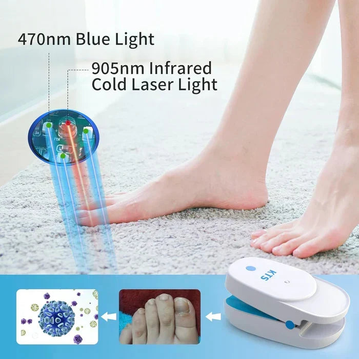 Dispositivo láser dual con luz azul y ultrapulso para uñas sanas y fuertes.