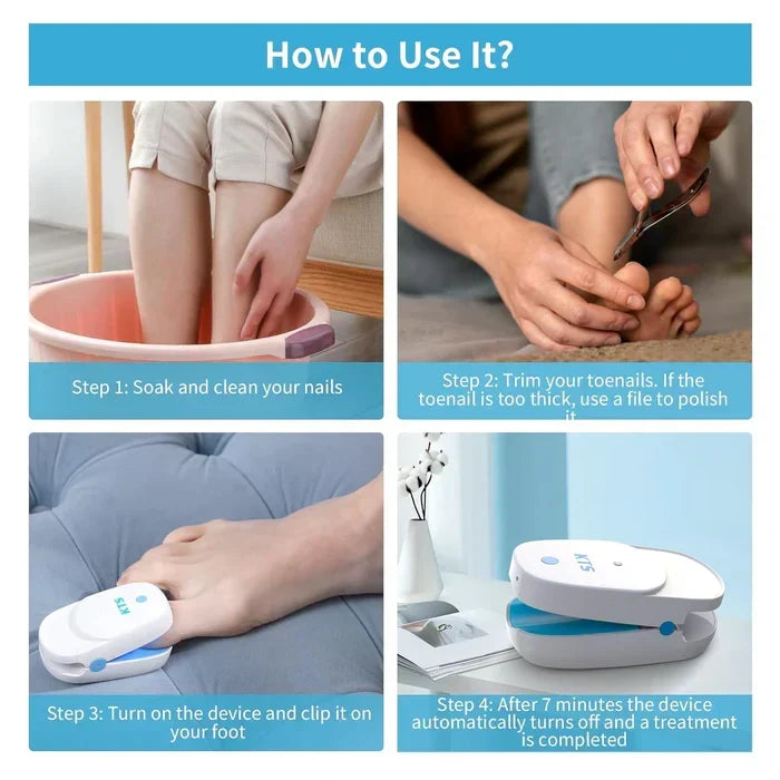 Tratamiento intensivo de uñas con dispositivo láser dual avanzado y portátil.