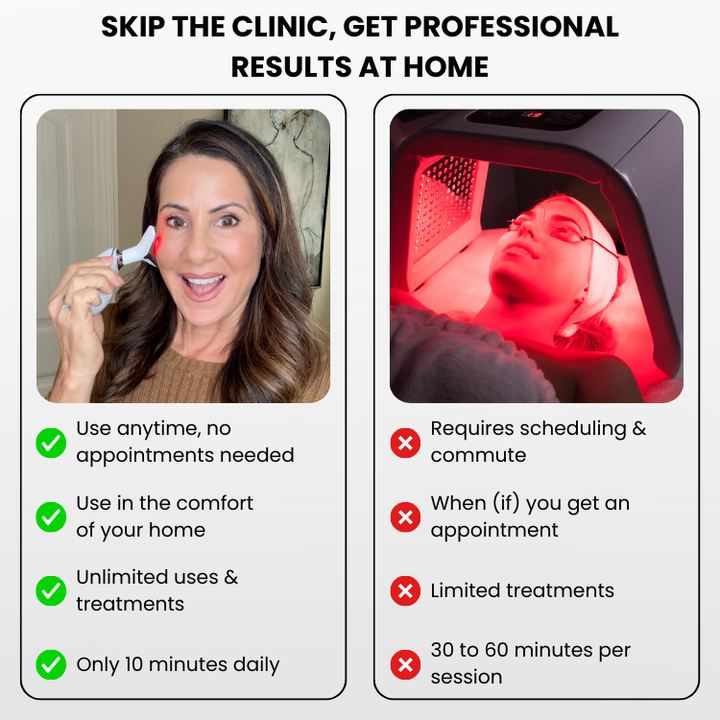 Dispositivo cosmético facial con terapia LED, calor y vibración para el tratamiento profundo de la piel.