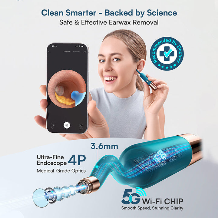 Dispositivo de limpieza de oídos con cámara HD, visión clara para eliminar cerumen de forma precisa.