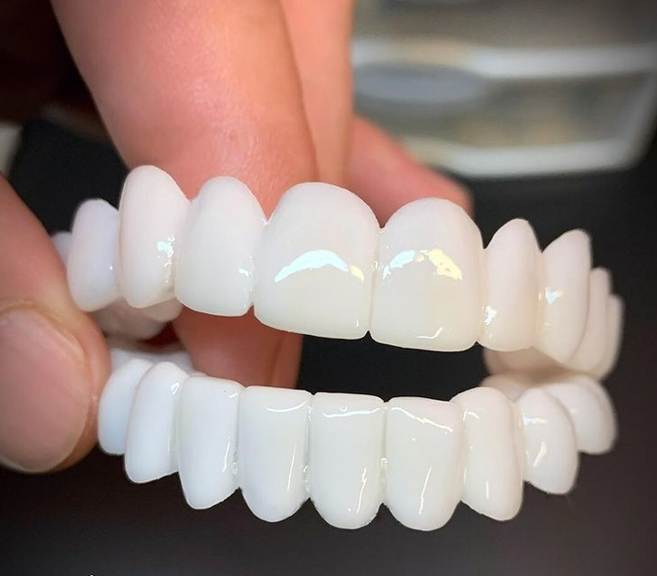 Dientes postizos cosméticos para recuperar la confianza. Solución dental estética y cómoda para una sonrisa ideal.