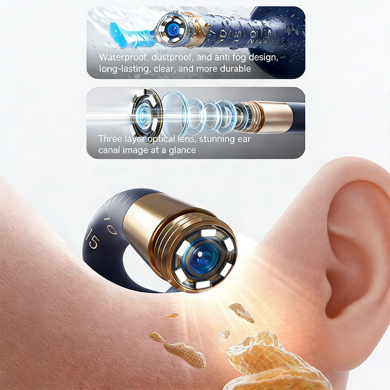 Endoscopio de oído con cámara HD, herramienta precisa para inspección y limpieza de oídos, salud familiar.