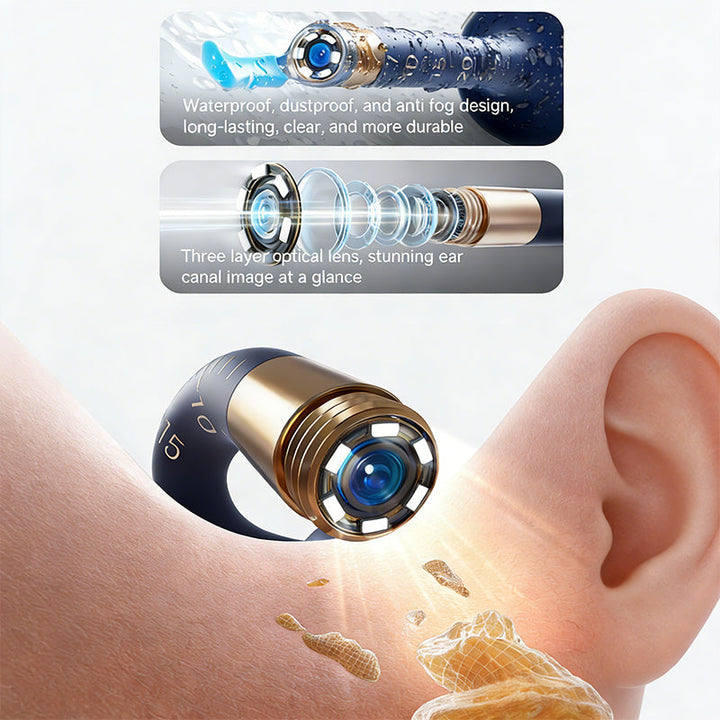 Endoscopio de oído con cámara HD, herramienta precisa para inspección y limpieza de oídos, salud familiar.