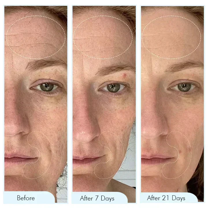 Mascarilla facial de hidrogel para noche, con bio-colágeno. Textura suave, hidratación profunda.