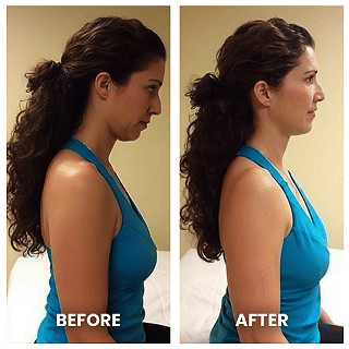 Dispositivo de tracción cervical 26° con EMS y calor para corrección de postura y alivio muscular.
