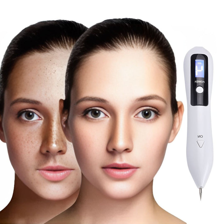 Pluma de plasma para cuidado de la piel: elimina verrugas, lunares y ayuda a borrar tatuajes.