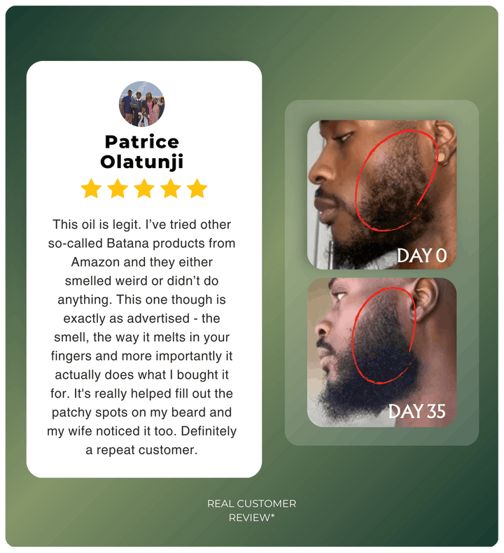Aceite de Batana para un cabello fuerte y con brillo. Tratamiento anticaída y crecimiento capilar natural.