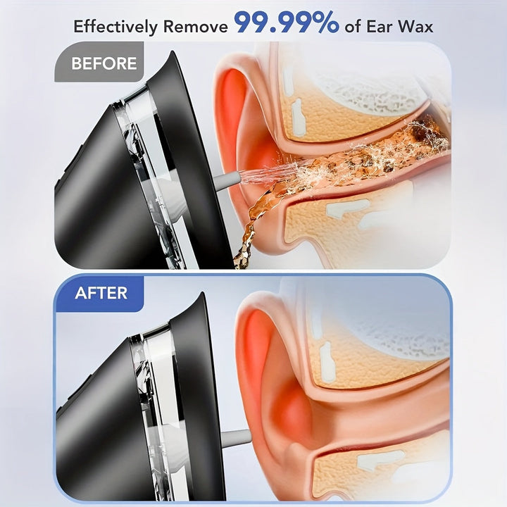 Dispositivo extractor de cerumen eléctrico para limpieza de oídos con agua, promoviendo bienestar auditivo.
