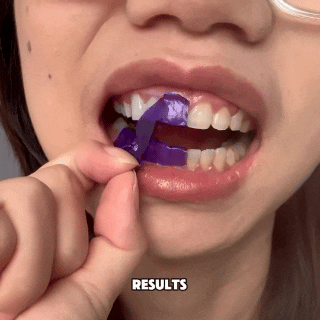 Mujer aplicando tiras blanqueadoras PAP Púrpura. Logra una sonrisa brillante y dientes blancos sin esfuerzo.