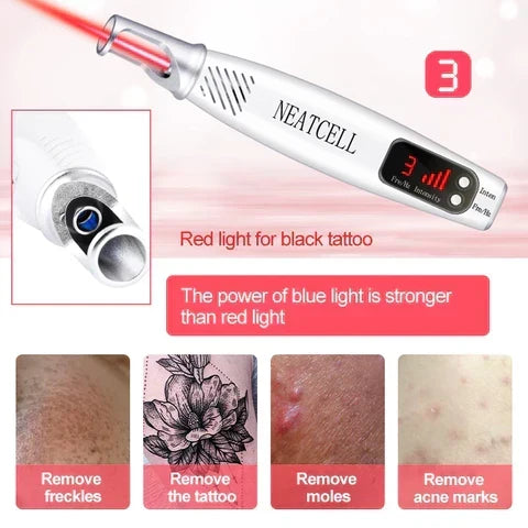 Láser picosegundos de precisión para eliminación segura y efectiva de imperfecciones y tatuajes de la piel.