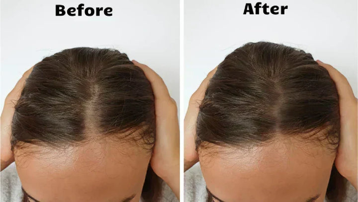 Regenerador capilar 4 en 1 con luz roja para cabello más fuerte, voluminoso y menos propenso a la caída.