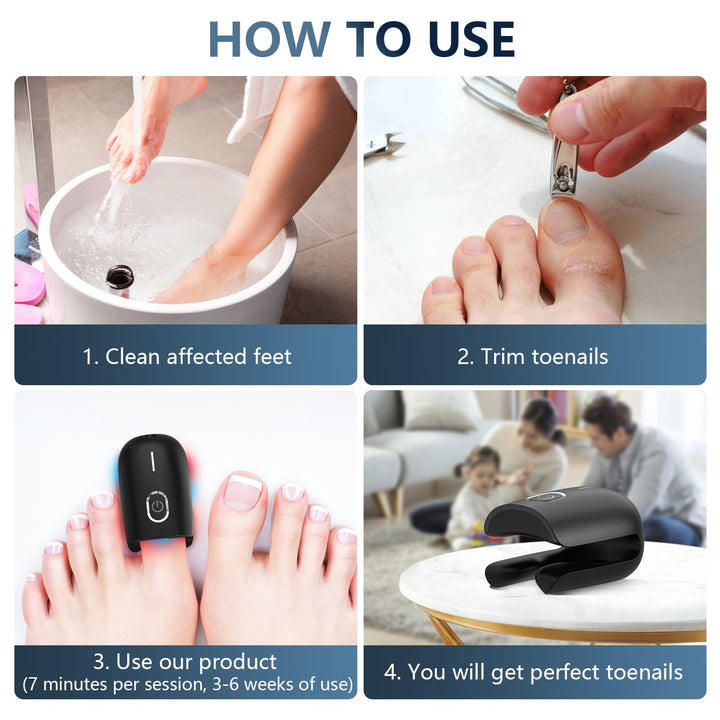 Dispositivo láser para la eliminación de hongos en uñas. Terapia de onicomicosis efectiva y recargable.