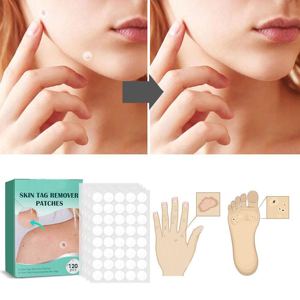 Hoja de parches SkinClear, tratamiento múltiple para verrugas y fibromas. Discretos y sin dolor para cuidado de piel.