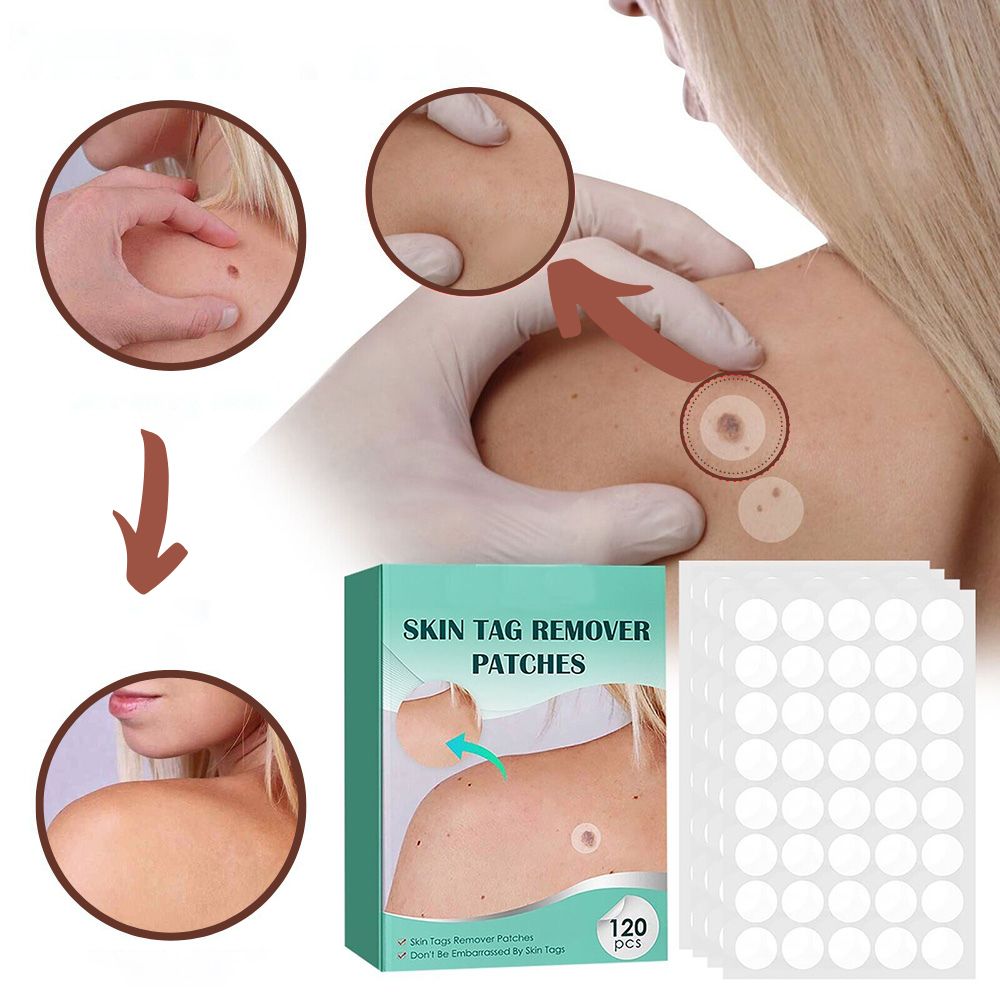 Parches SkinClear, tratamiento indoloro y discreto para eliminar verrugas y fibromas. Cuidado y belleza de la piel.