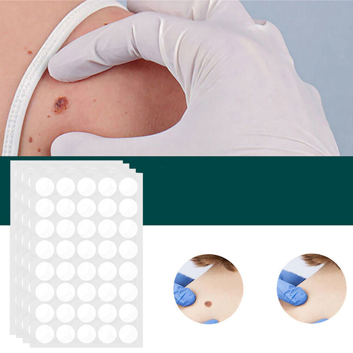 Primer plano de un parche hidrocoloide SkinClear, ultrafino y discreto. Solución para el cuidado y tratamiento de verrugas.