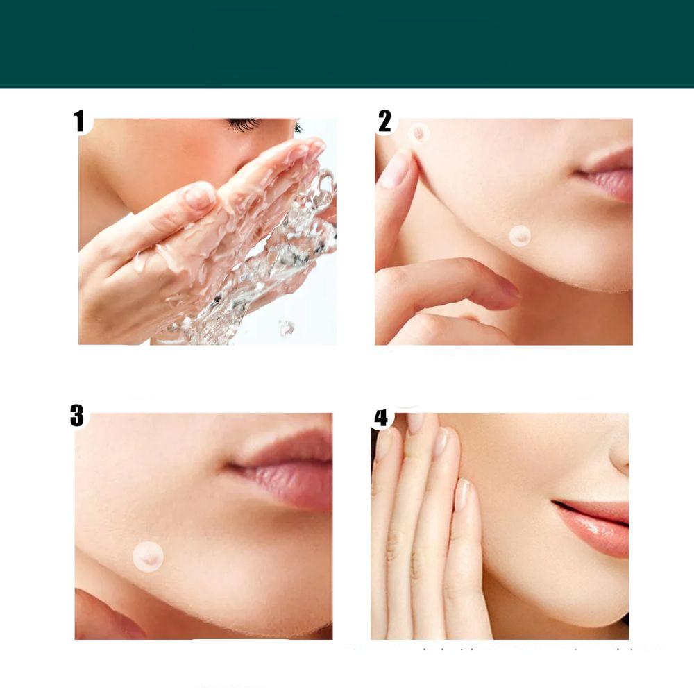 Caja de Parches SkinClear, tu remedio discreto y sin dolor para eliminar verrugas y fibromas. Cuidado de la piel.