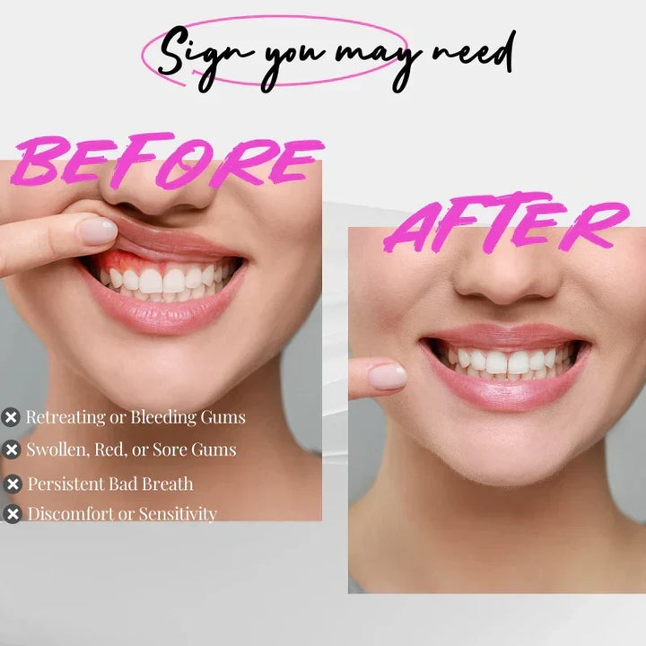Cuidado bucal completo con dispositivo de luz oral para encías y dientes fuertes.