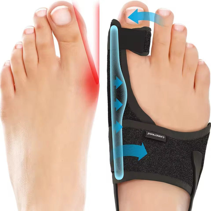 Soporte ergonómico nocturno para hallux valgus. Férula unisex para juanetes, corrección del pie y confort.