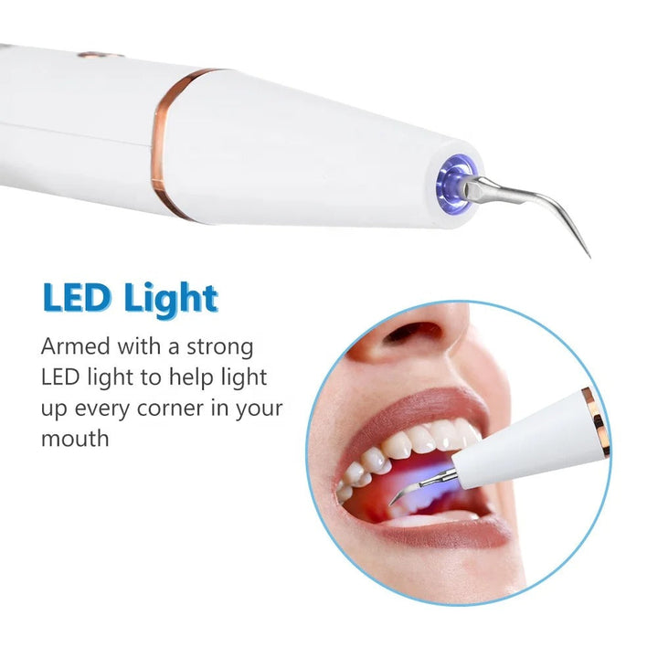 Tecnología ultrasónica avanzada para remover sarro y placa, esencial para la belleza y salud dental.