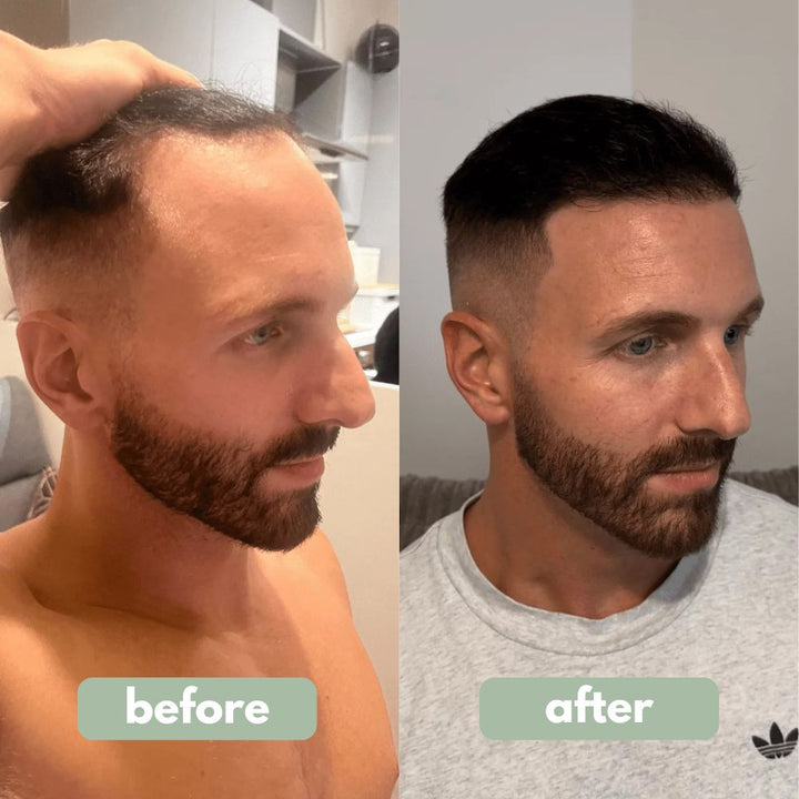 Serum capilar pro-crecimiento con Redensyl, Anagain, Aminexil y romero. Tratamiento fortalecedor anticaída.