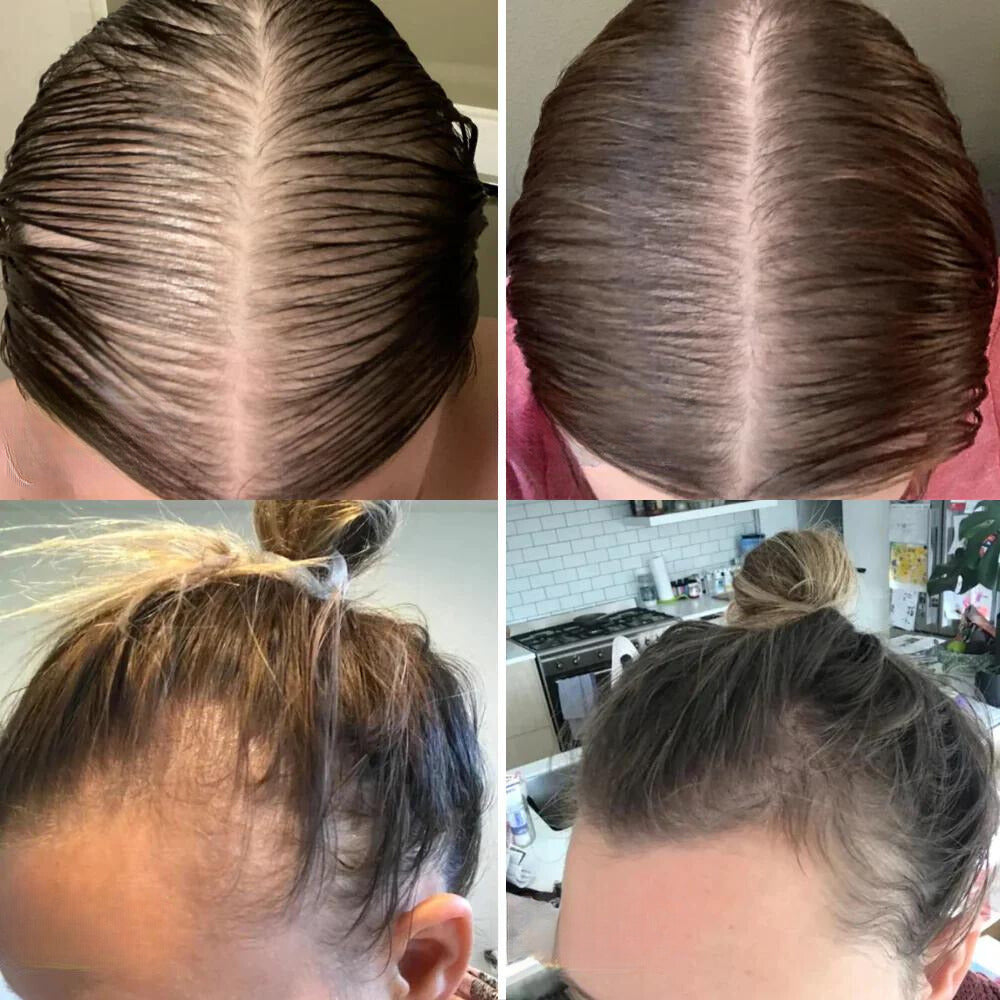 Botella de aceite de crecimiento capilar natural que promueve el volumen y fortalece el cabello fino.