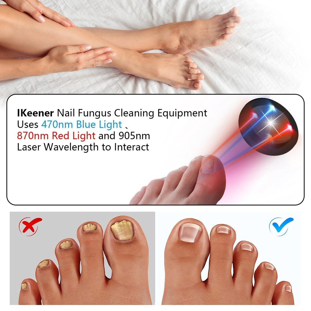 Dispositivo láser para hongos en uñas en su empaque original. Tratamiento onicomicosis, recargable.