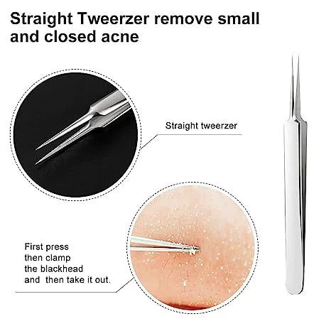 Herramientas de precisión para el cuidado de la piel, extractor de puntos negros y pinzas.