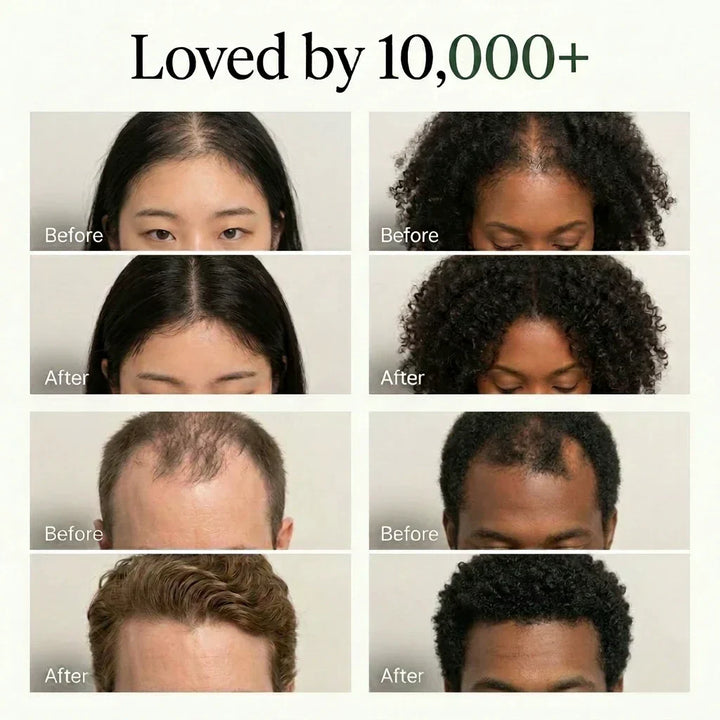 Barra limpiadora vegana para cuero cabelludo. Fomenta el cabello sano con 12 hierbas fermentadas unisex.